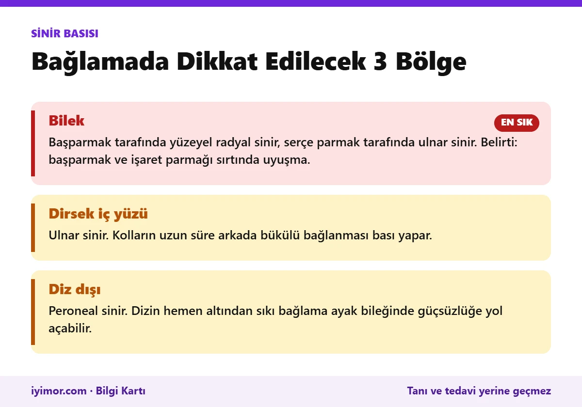 Bilekte Yüzeyel Radyal Ve Ulnar Sinir, Dirsekte Ulnar Sinir Ve Dizde Peroneal Sinir Bası Bölgelerini Gösteren Kart